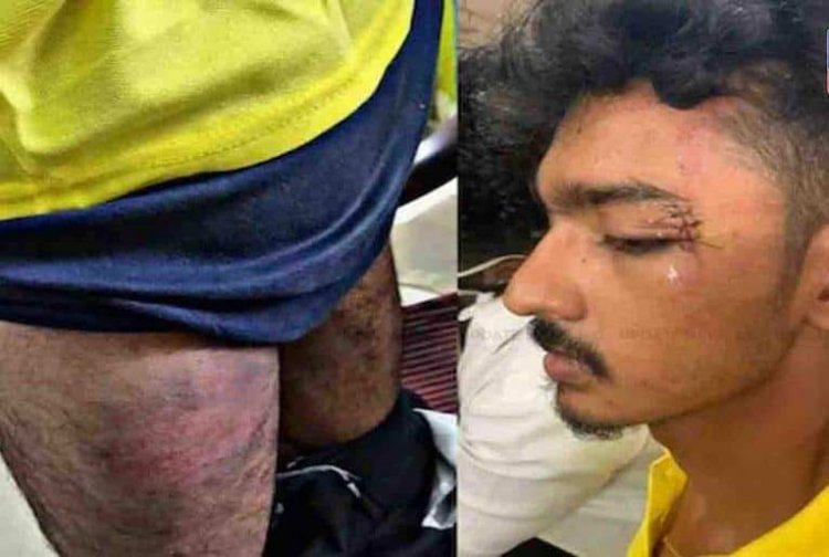 நிர்வாணப்படுத்தி தாக்கிய காவலர்கள்! சட்ட கல்லூரி மாணவர் புகார்!
