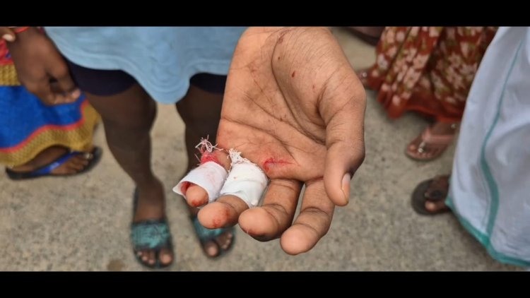 சிறுவன் கையை வெட்டிய முகமுடி நபர்!